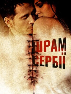 Сербські шрами